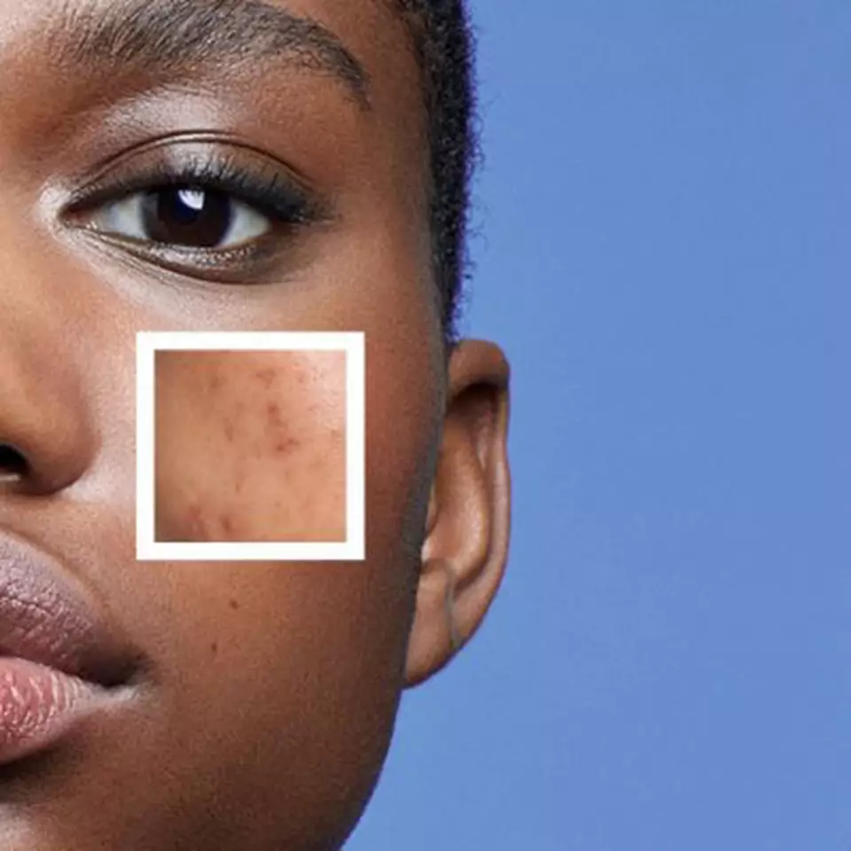 SKINCARE TIPS AND ADVICE